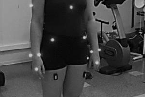 Patiente équipée de capteurs réfléchissants